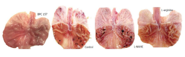 Celecoxib-induced gastric lesions in rats treated with BPC-157